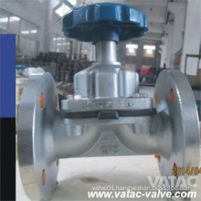 Ss304/Ss316 Wire Diaphragm Valve